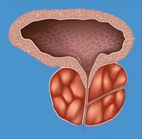 Einige der charakteristischen zeichen der prostatitis