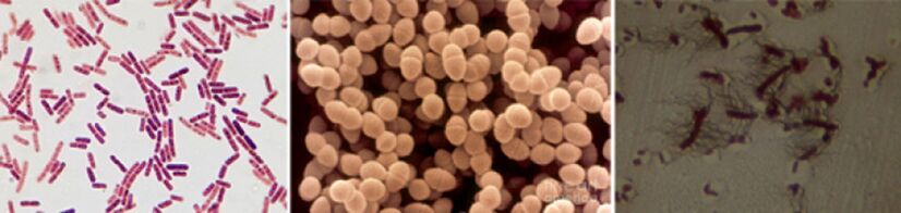 E. coli, fäkale Enterokokken und Proteus sind die wichtigsten ätiologischen Erreger der chronischen bakteriellen Prostatitis