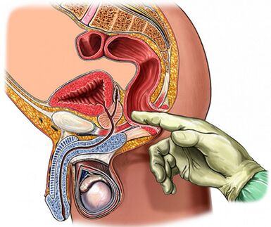 Prostatauntersuchung des Fingers