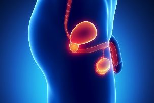 Die entzündung der prostata
